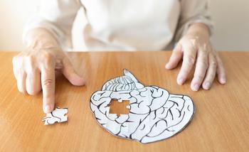 Alzheimer
